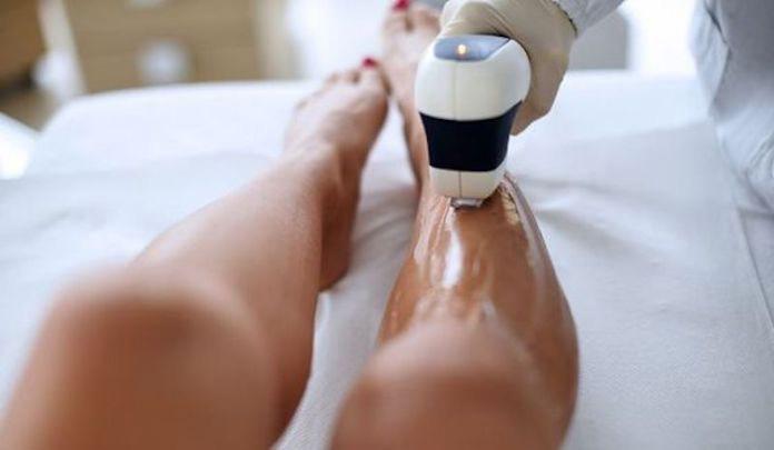 Laser Depilation
